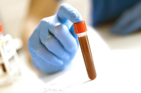 COVID-19 Antibody Testing Is Here 